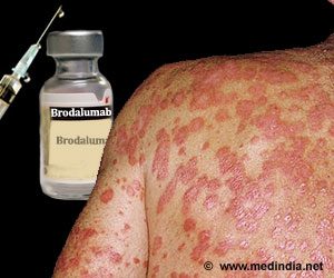 psoriasis-brodalumab