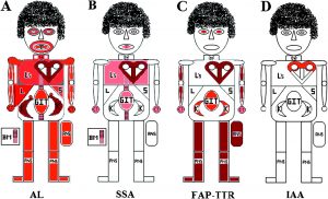 heartjnl-2011-January-97-1-75-F2.large
