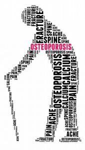 osteoporosis26549542_M